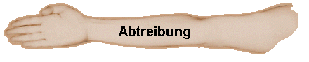 Abtreibung
